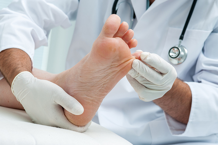 Doctor dermatologist examines the foot on the presence of athlet